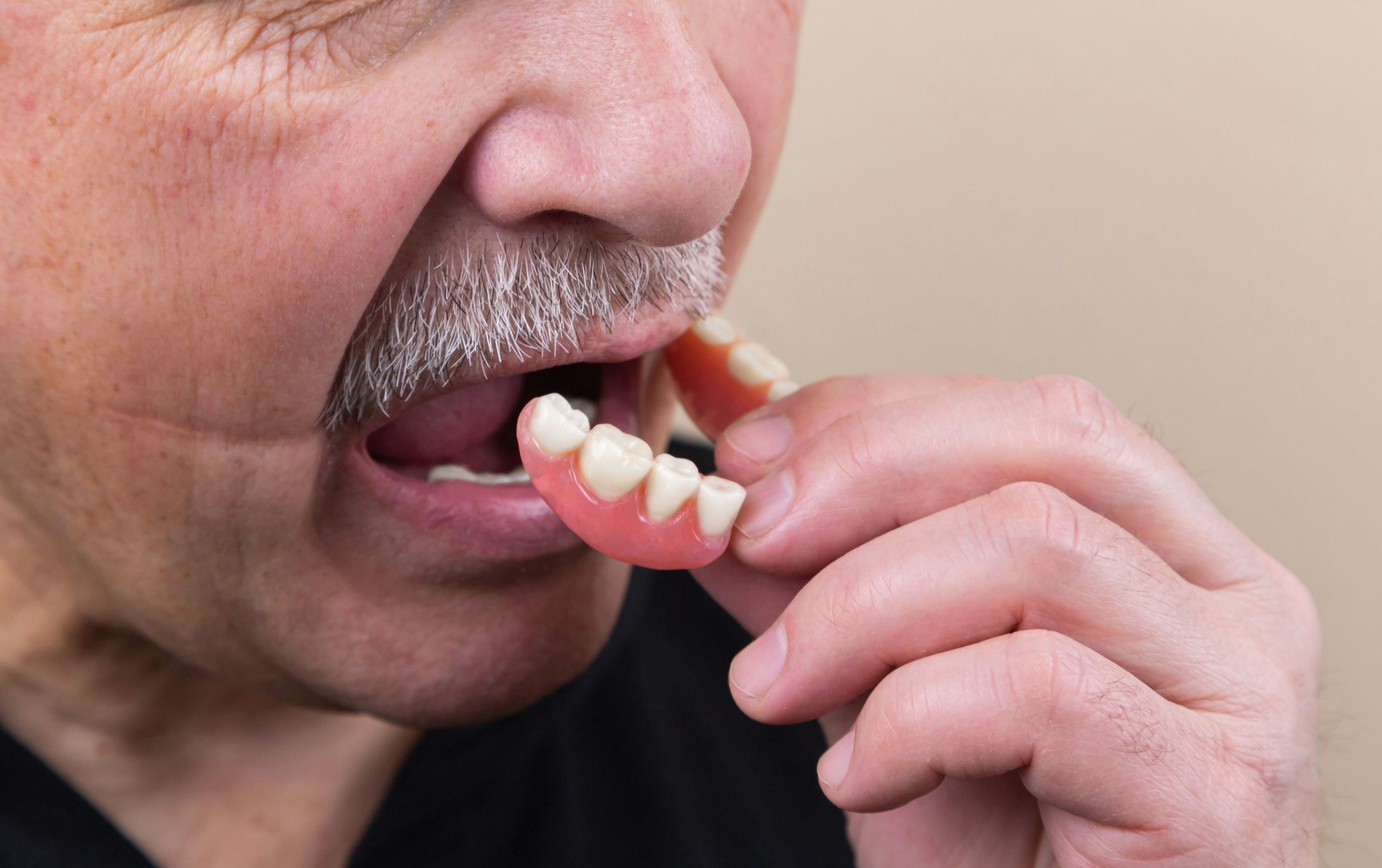 The Ultimate Guide to Choosing Dentures for a Natural-Looking Smile
