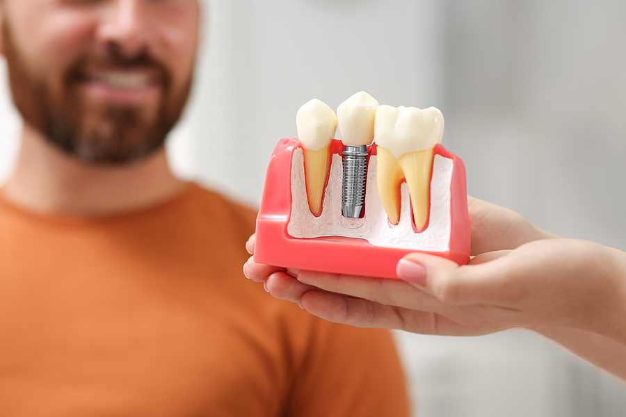 Reasons Why You Should Replace Missing Teeth