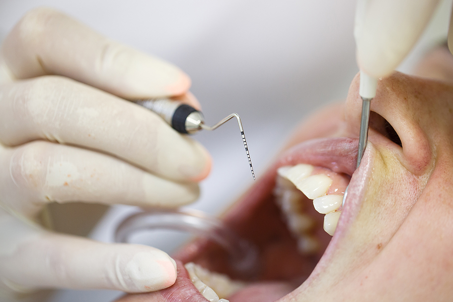 Comprehensive Guide to Periodontics: Safeguarding Your Gum Health