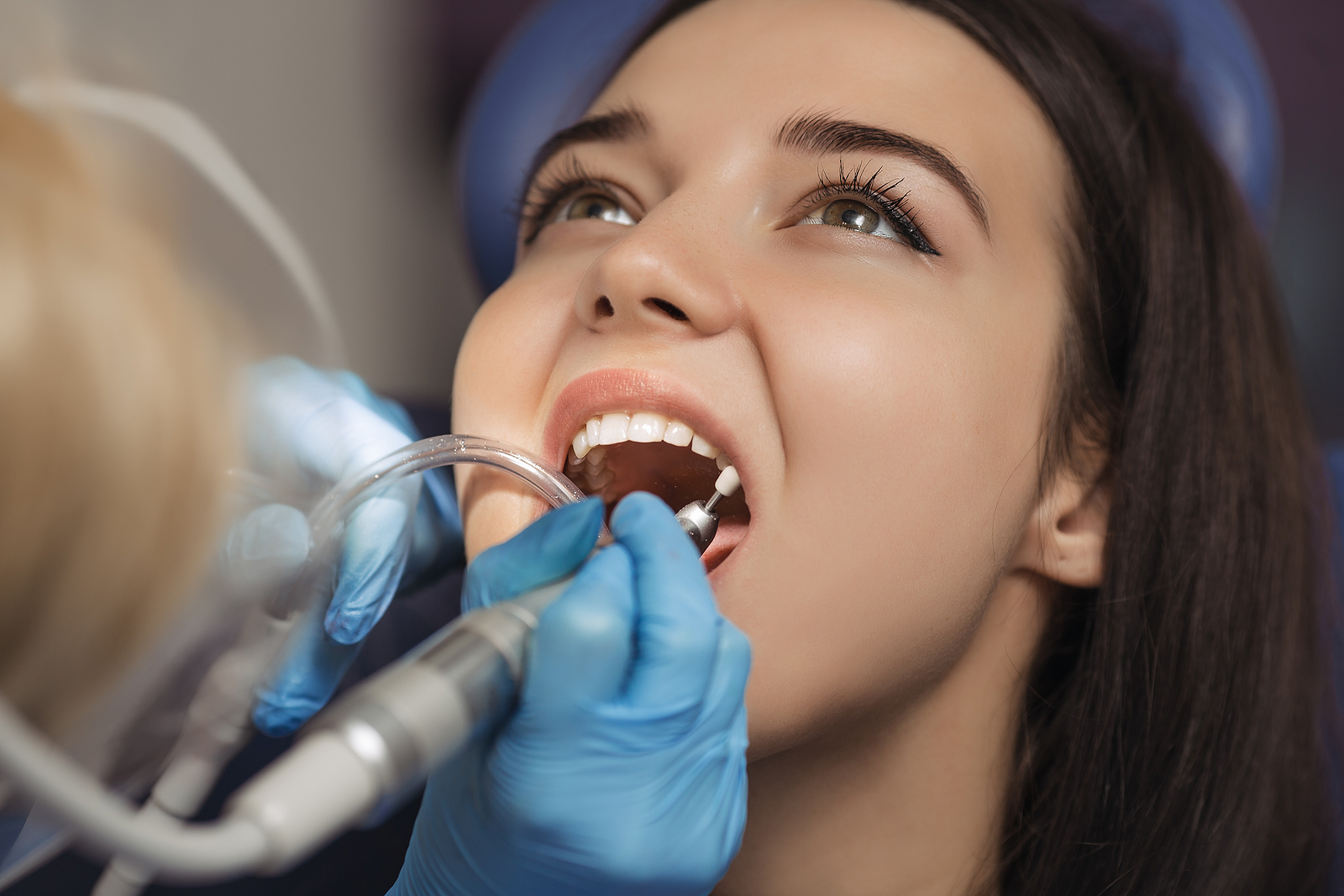 How to Care for Your Mouth After Wisdom Teeth Extraction