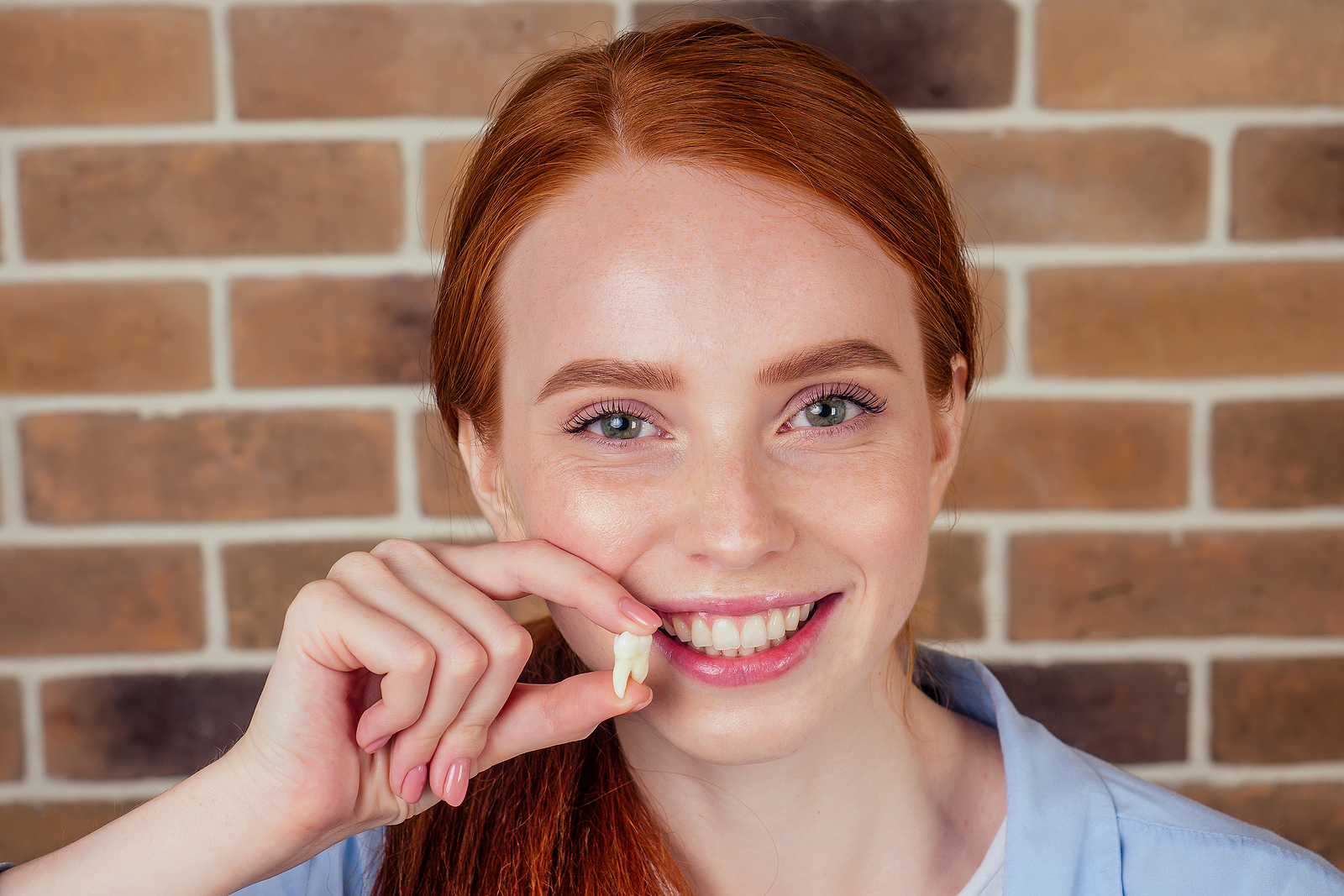Understanding the Importance of Wisdom Teeth Removal in Federal Way, WA
